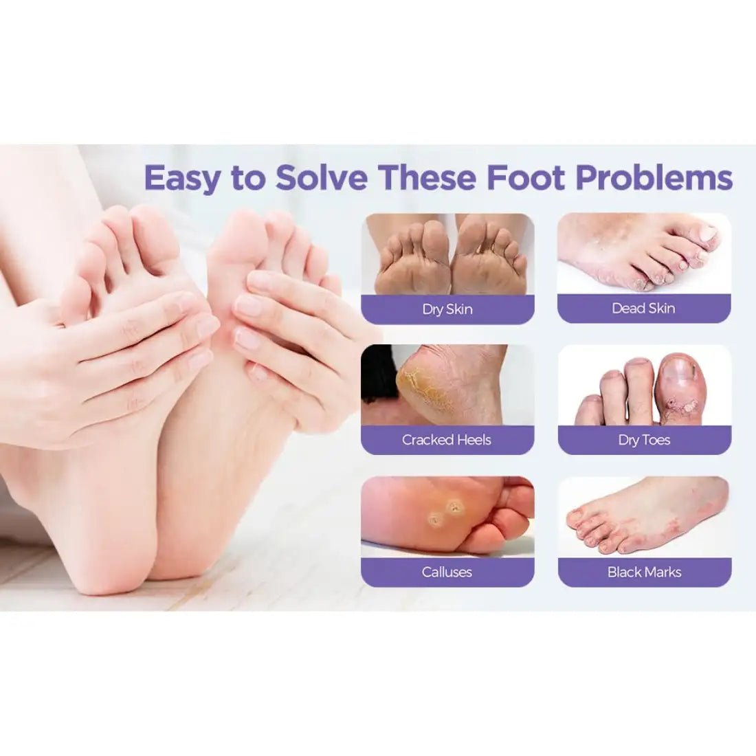 Goat Milk Exfoliating Foot Mask with Nicotinamide | Deep Moisturising & Dead Skin Removal Foot Mask - Dreamzhub