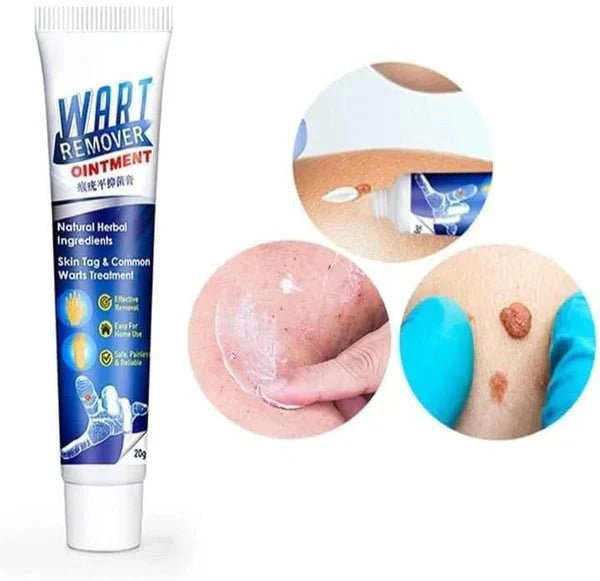 Wart Remover Cream - Dreamzhub