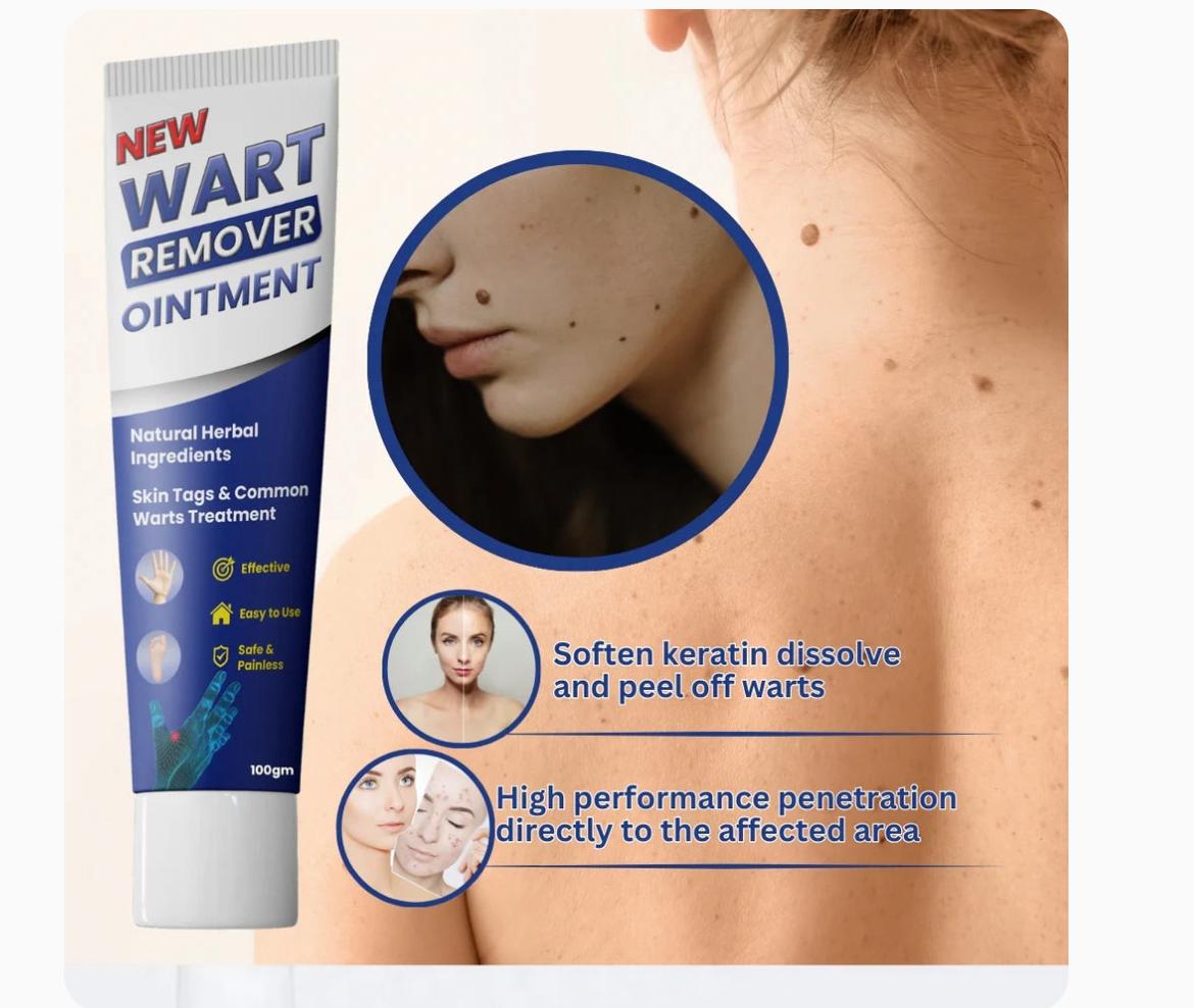 Wart Remover Cream - Dreamzhub
