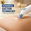 4 In 1 Multi-Function Blackhead Remover With Free Mens Trimmer