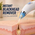 4 In 1 Multi-Function Blackhead Remover With Free Mens Trimmer