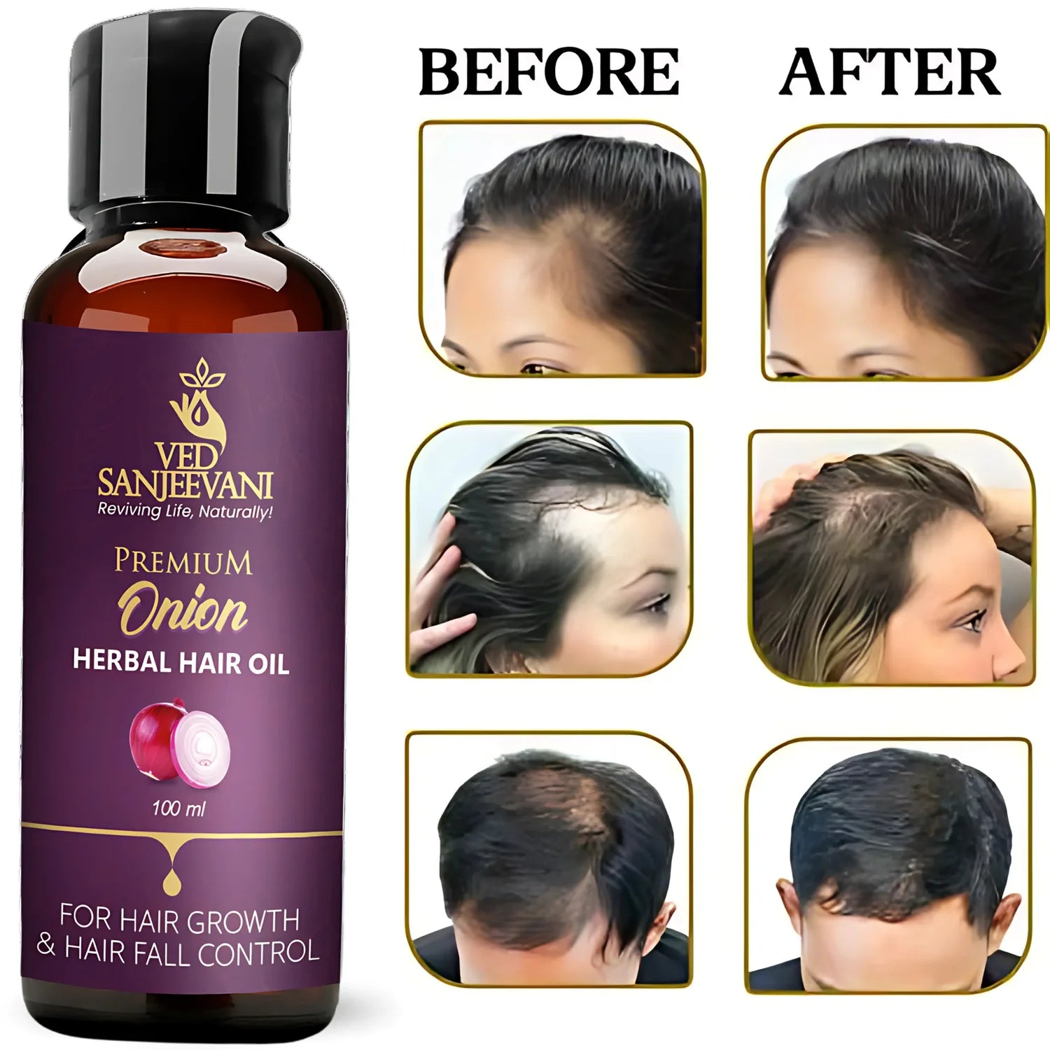 Onion Herbal Hair Oil