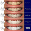 Teeth Whitening Strips Kit