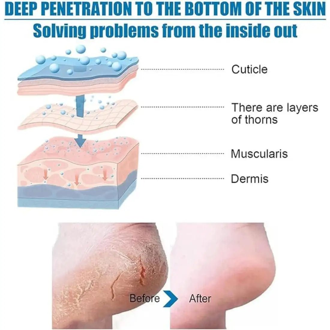 Goat Milk Exfoliating Foot Mask with Nicotinamide | Deep Moisturising & Dead Skin Removal Foot Mask - Dreamzhub