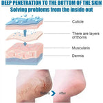 Goat Milk Exfoliating Foot Mask with Nicotinamide | Deep Moisturising & Dead Skin Removal Foot Mask - Dreamzhub