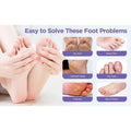 Goat Milk Exfoliating Foot Mask with Nicotinamide | Deep Moisturising & Dead Skin Removal Foot Mask - Dreamzhub