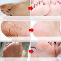 Goat Milk Exfoliating Foot Mask with Nicotinamide | Deep Moisturising & Dead Skin Removal Foot Mask - Dreamzhub