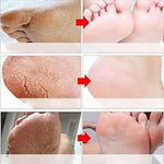 Goat Milk Exfoliating Foot Mask with Nicotinamide | Deep Moisturising & Dead Skin Removal Foot Mask - Dreamzhub