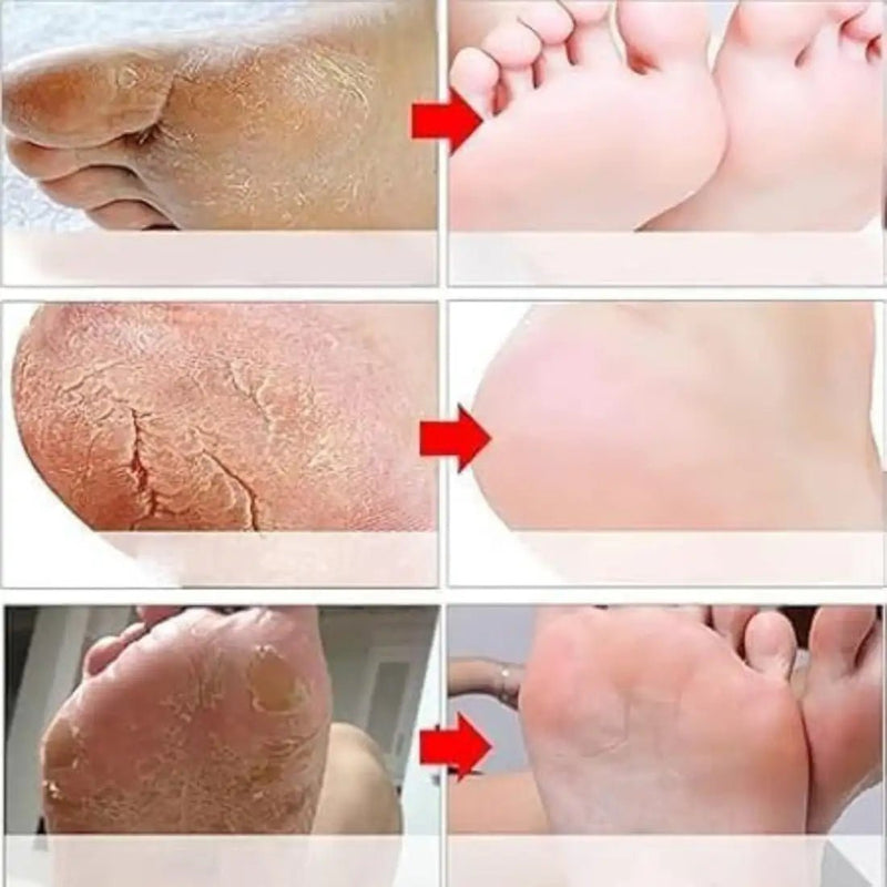 Goat Milk Exfoliating Foot Mask with Nicotinamide | Deep Moisturising & Dead Skin Removal Foot Mask - Dreamzhub