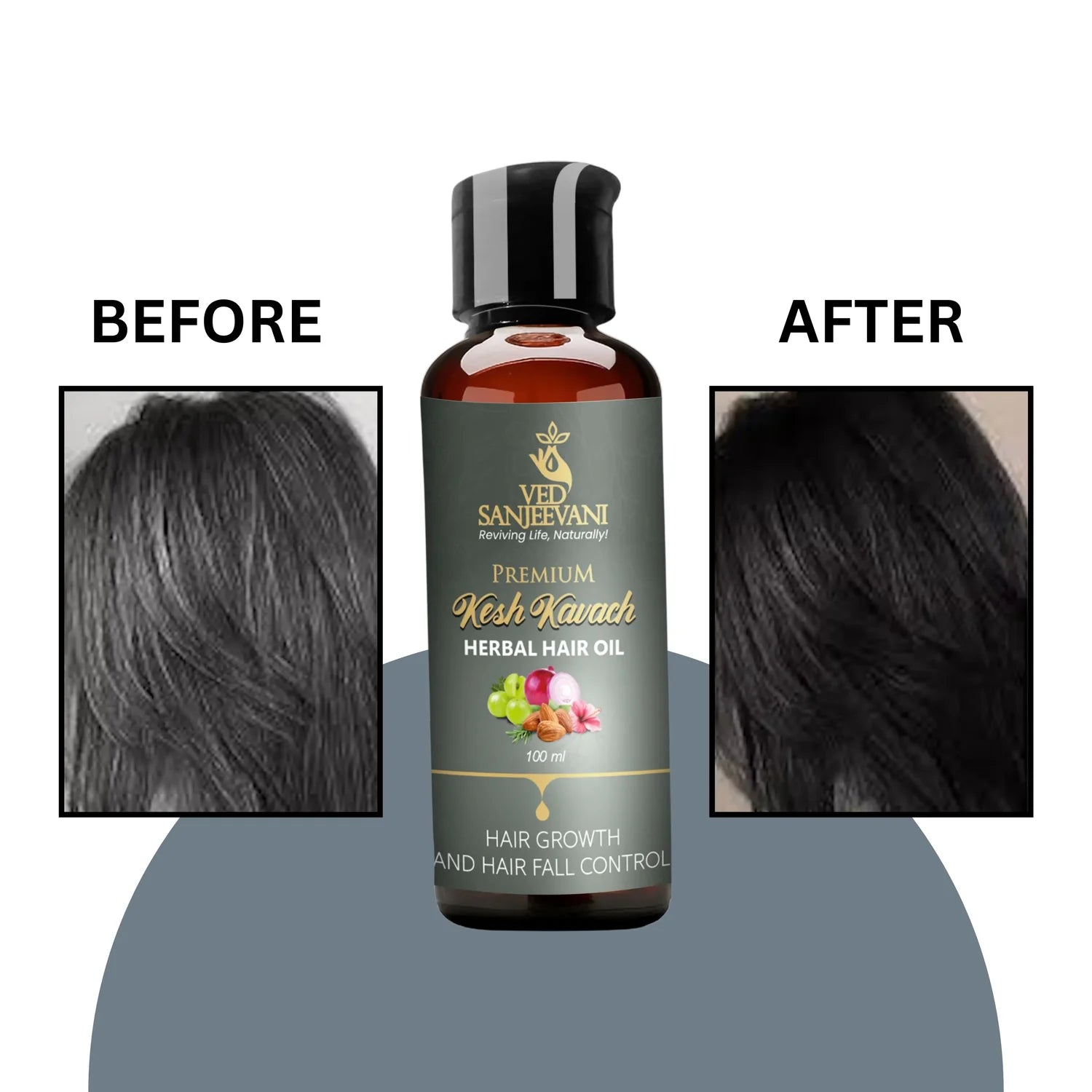 Kesh Kavach Herbal Hair Oil