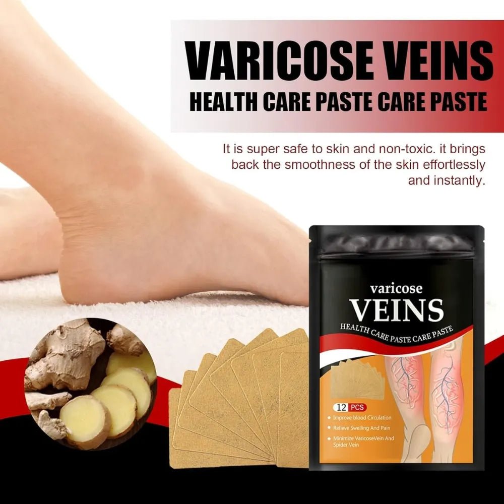 Varicose Veins Health Care Paste | Pain Relief & Blood Circulation Support - Dreamzhub
