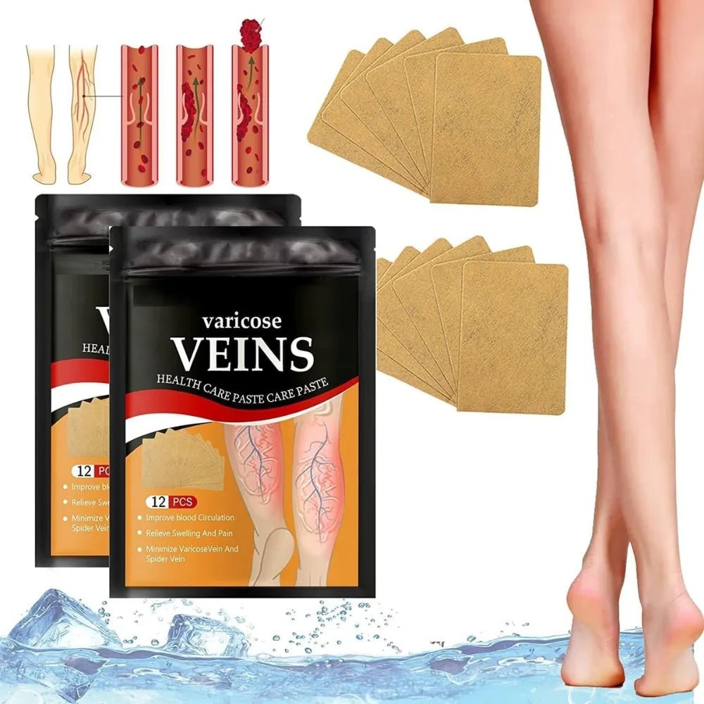 Varicose Veins Health Care Paste | Pain Relief & Blood Circulation Support - Dreamzhub