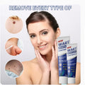 Wart Remover Cream - Dreamzhub