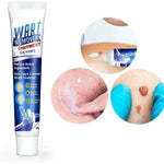 Wart Remover Cream - Dreamzhub