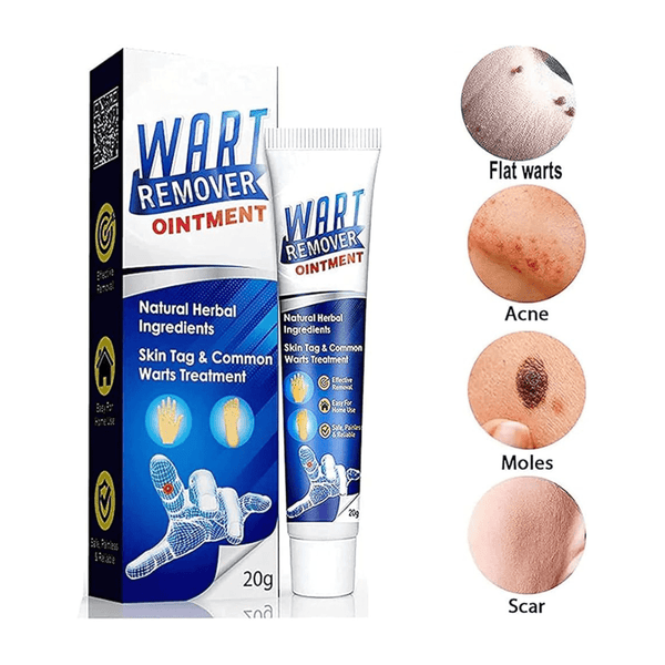 Wart Remover Cream