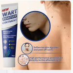 Wart Remover Cream - Dreamzhub