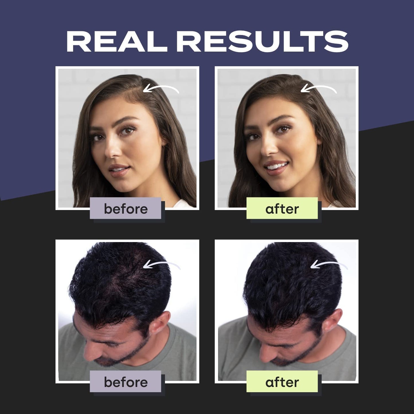 Hair Building Fiber Pro